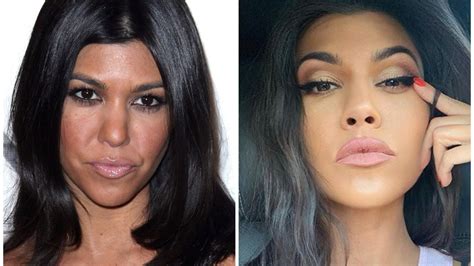 Kim Kardashian Before And After Plastic Surgery Timeline