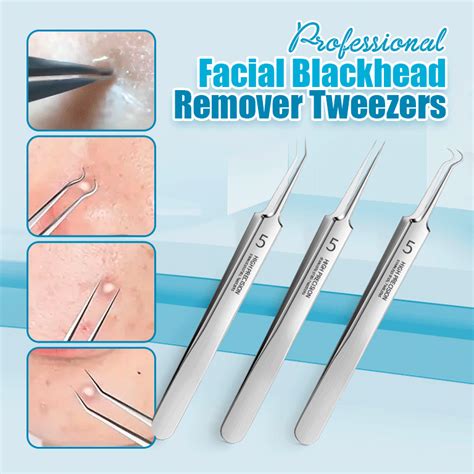 Professional Facial Blackhead Remover Tweezers