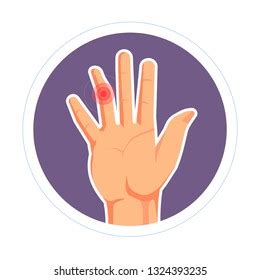 Swollen Finger Stock Illustrations Images Vectors Shutterstock