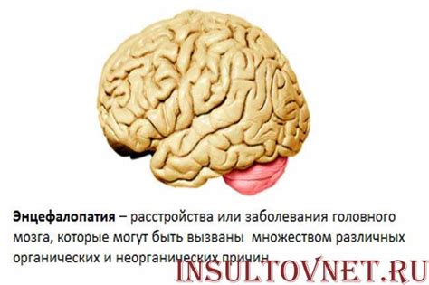 Постаноксическая энцефалопатия: симптомы и лечение болезни