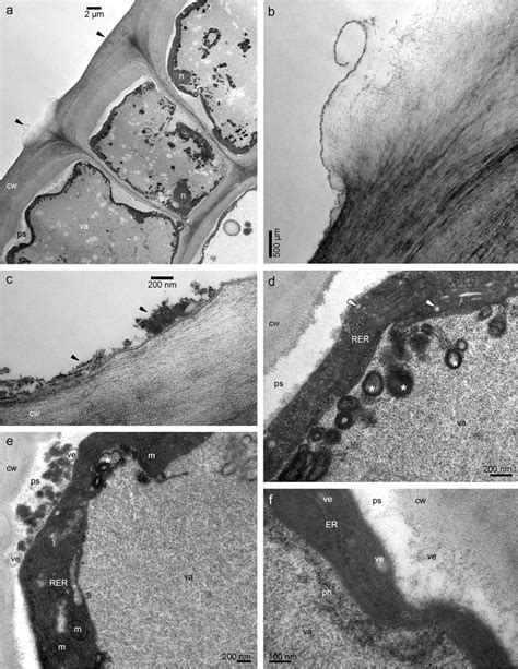 The Observations Of The Epidermis Of Lip Base With Flat Callus From