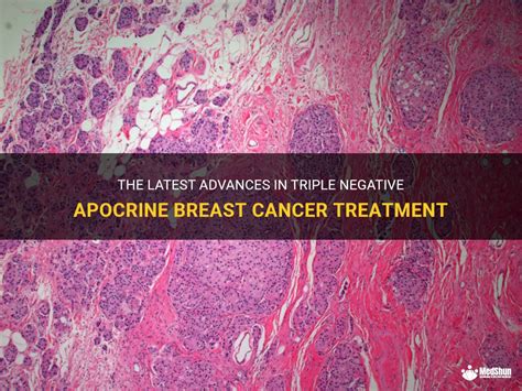 The Latest Advances In Triple Negative Apocrine Breast Cancer Treatment Medshun