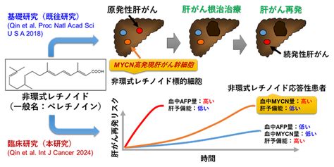 肝がん予防のための患者層別化マーカーを発見 理化学研究所