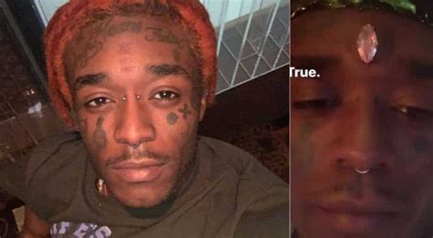 Rapper Lil Uzi Vert Gets A Diamond Implant On His Forehead Like Marvel
