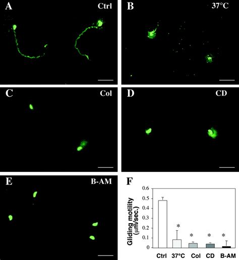 Apical Organelle Discharge By Cryptosporidium Parvum Is Temperature