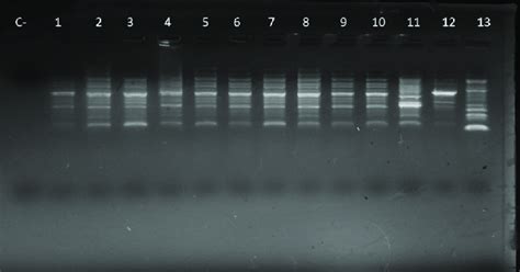 Clonal Relationship Among Ochrobactrum Anthropi Oa Isolates