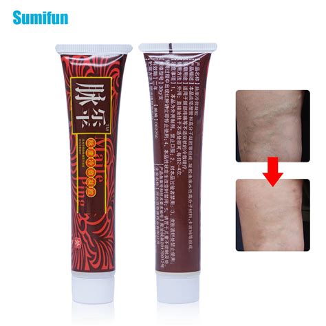 The 10 Best Varicose Veins Creams Of 2019reviews