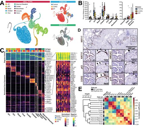 Identification Of Aberrant Basaloid Cells In Ipf And Copd Lungs