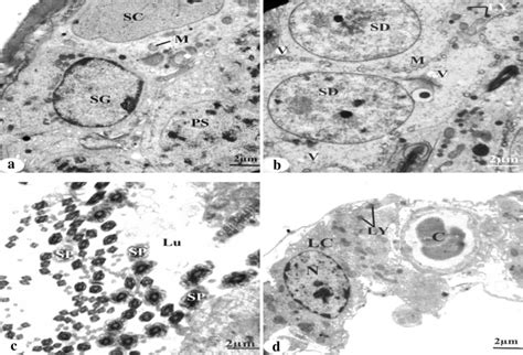 A D Electron Micrograph Of A Portion Of A Seminiferous Tubule Of Testis