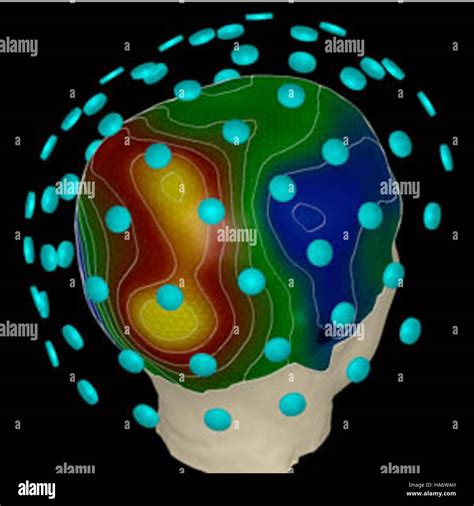 Magnetoencefalograf A Fotograf As E Im Genes De Alta Resoluci N Alamy