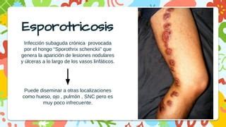 Descripci N Y Caracter Sticas De La Esporotricosis Ppt