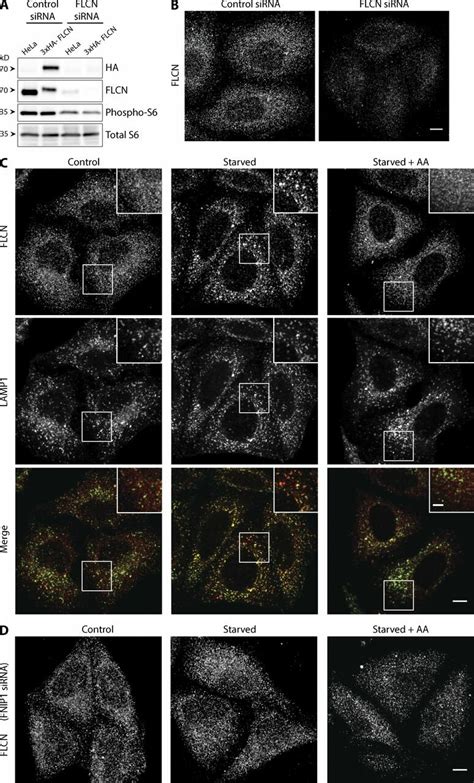 Regulation Of The Lysosomal Recruitment Of Flcn By Amino Acid