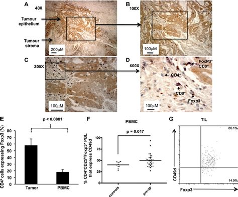 Proportions Of Cd4 Cells Expressing Foxp3 In Tumours And Blood Of