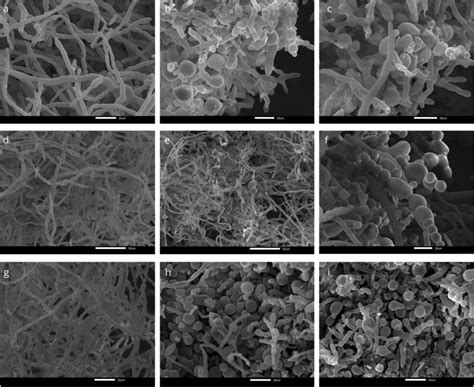 SEM Scanning Electron Microscopy Of Mucor Sp CM3 Mycelium Treated