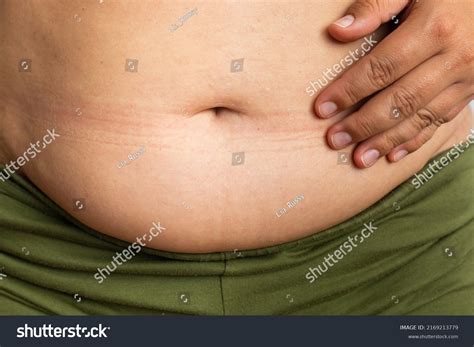 Cropped Overweight Fat Female Belly Touching Shutterstock