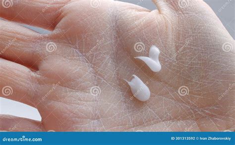 Using Hand Cream For Dry Skin Close Up Moisturizing Palms And Treating