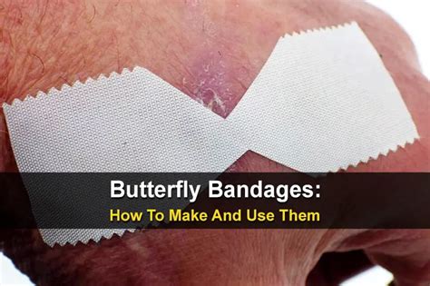 Butterfly Bandages How To Make And Use Them