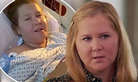 Amy Schumer Gives A Glimpse Into Her Lonely Battle With Endometriosis