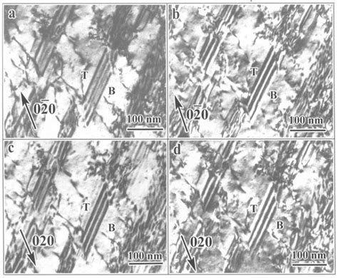 Complementary Bright Dark Field Tem Images Of Stacking Faults In