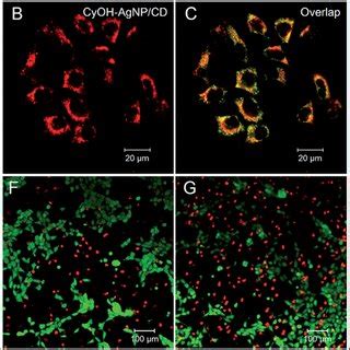 Colocalization Images Of The 4T1 Cells Stained With MitoTracker And