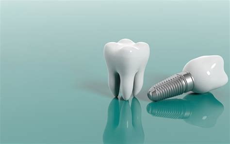 Trồng răng Implant giá bao nhiêu và một số vấn đề liên quan