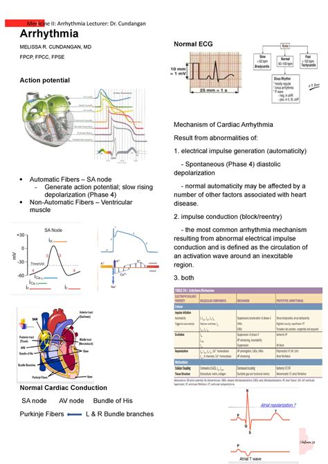 Med Ii Le1 103 Arrhythmia Notes Arrhythmia Melissa R Cundangan Md