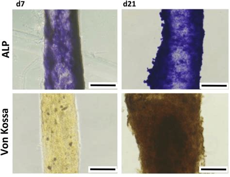 Alkaline Phosphatase Staining And Mineralization Evaluation Of D1 Cells