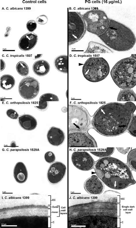 Transmission Electron Micrographs Of Candida Strains Comparing Control