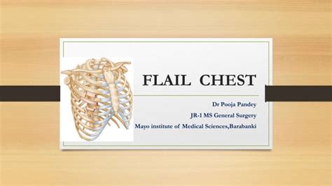 Flail Chest Ppt