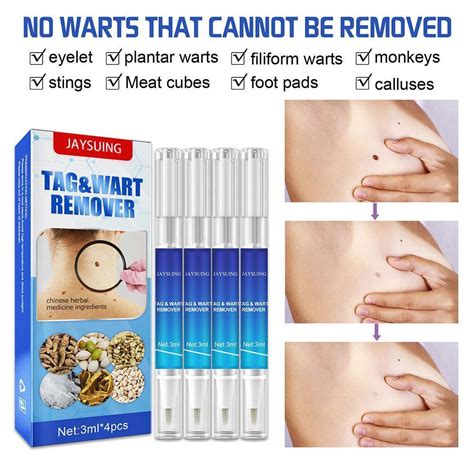 Wipe Off Tags Moles Remover 1 4pcs EBay