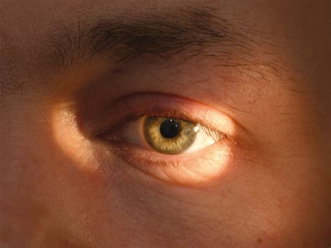 Evaluación de la profundidad de la cámara anterior del ojo. A y B ...