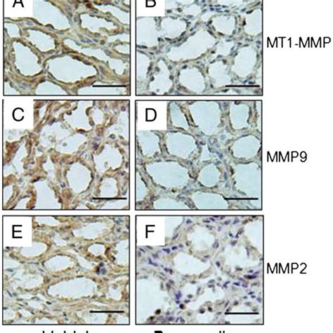 Mt1 Mmp Induces Cell Proliferation And Cyst Growth In 3d Collagen I Gel