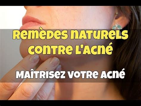 MAÎTRISEZ VOTRE ACNÉ MÉTHODE 100 NATURELLE CONTRE L ACNÉ YouTube