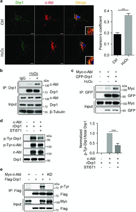 C Abl Interacts With And Phosphorylates Drp1 A Left Panel Primary