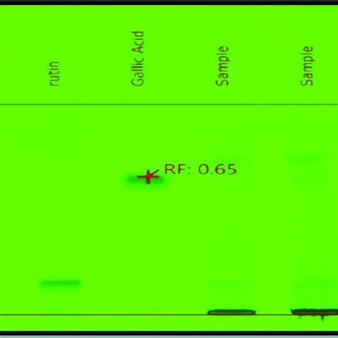 Hptlc Plate With Standard Gallic Acid Rutin And Tea Extract At 305 Nm