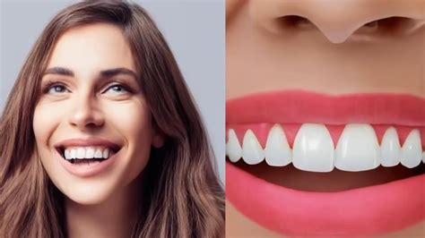 How To Strengthening Your Teeth And Gums Naturally A Comprehensive