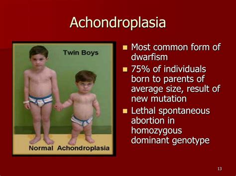 Ppt Chapter 11 Complex Inheritance And Human Heredity Powerpoint