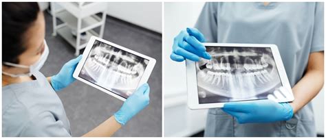 Dental Imaging – triodent.com.tr