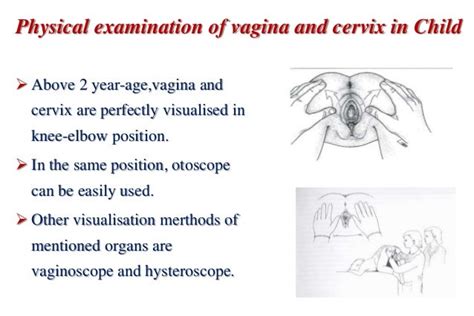 Pediatric And Adolescent Gynecology Koc Univ Web