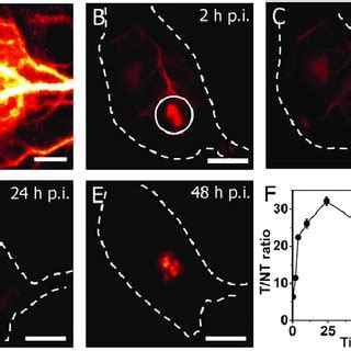 NIR II Fluorescence In Vivo Functional Bioimaging