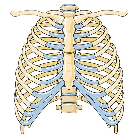 Sternal Fracture Vector