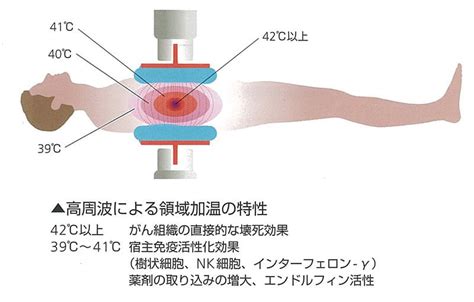 癌 温熱療法 効果 Hello Doctor