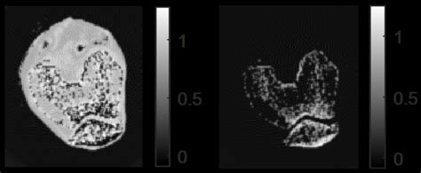 Representative Numerical Phantom Of The Material Mass Densities Download Scientific Diagram