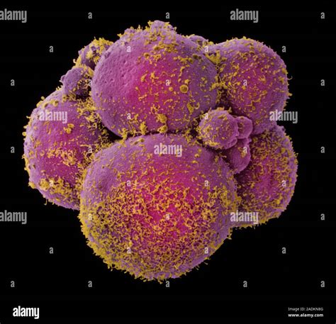 Eight Cell Embryo Coloured Scanning Electron Micrograph Sem Of A