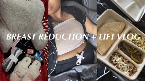 Breast Reductionlift Vlog Youtube