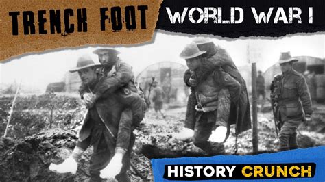 World War 1 Trench Foot