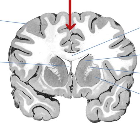 Overview Of Cns And Pns Flashcards Quizlet