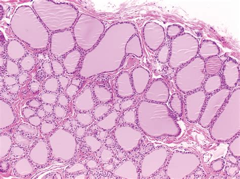 Thyroid Histology C Cells