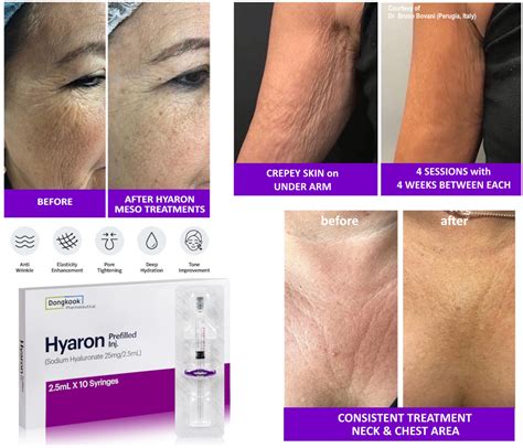 Hyaron Skin Booster Glow Kit Syringes X Ml