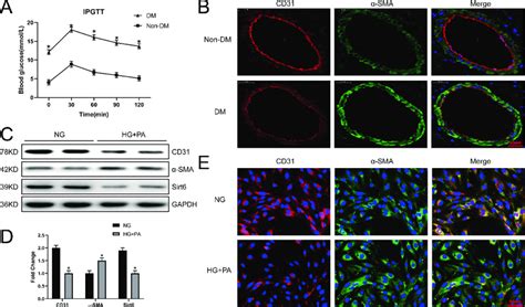 Sirt Is Downregulated In Cmecs In Response To Endmt Induced By Hg Pa